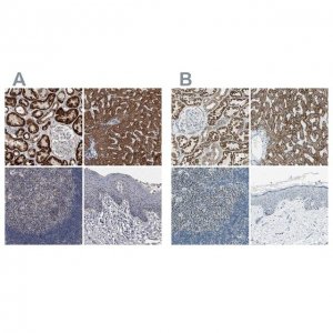 Anti-ACADM antibody produced in rabbit 