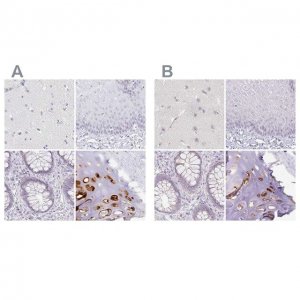 Anti-ACAN antibody produced in rabbit 