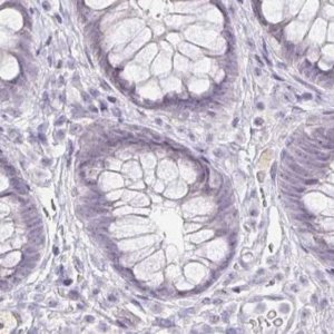 Anti-ACAN antibody produced in rabbit 