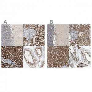 Anti-ACAT1 antibody produced in rabbit 