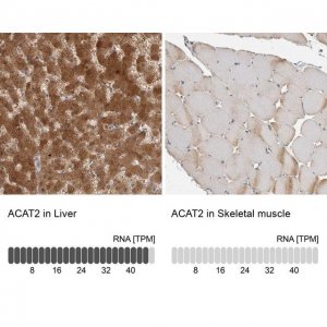 Anti-ACAT2 antibody produced in rabbit HPA025765-100UL