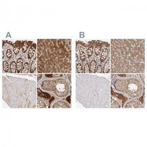 Anti-ACAT2 antibody produced in rabbit HPA025765-100UL