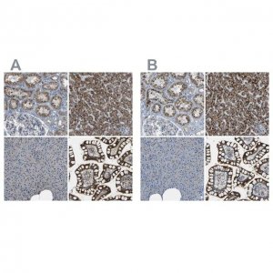 Anti-ACBD5 antibody produced in rabbit 