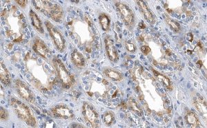 Anti-ACC1 Antibody, clone 1J8 ZooMAb Rabbit Monoclonal 