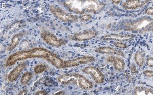 Anti-ACC1 Antibody, clone 1J8 ZooMAb Rabbit Monoclonal 