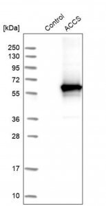Anti-ACCS antibody produced in rabbit 