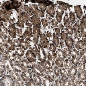 Anti-ACCS antibody produced in rabbit 