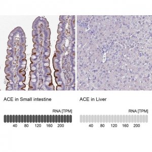Anti-ACE antibody produced in rabbit HPA029298-100UL