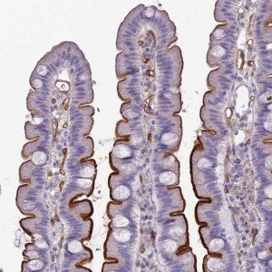 Anti-ACE antibody produced in rabbit HPA029298-100UL
