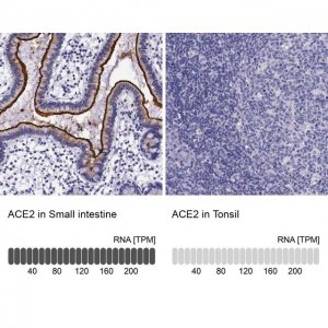 Anti-ACE2 antibody produced in rabbit HPA000288-100UL