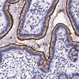 Anti-ACE2 antibody produced in rabbit HPA000288-100UL