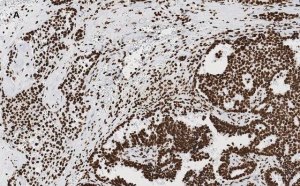 Anti-Acetyl Histone H3 (Lys9 and 14) Antibody, clone 5H20, ZooMAb Rabbit Monoclonal 