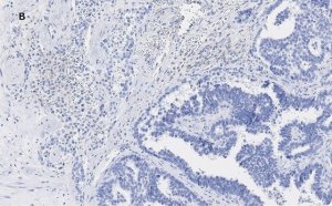 Anti-Acetyl Histone H3 (Lys9 and 14) Antibody, clone 5H20, ZooMAb Rabbit Monoclonal 