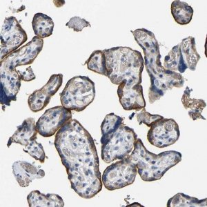 Anti-ACKR2 antibody produced in rabbit 