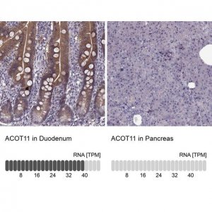 Anti-ACOT11 antibody produced in rabbit 