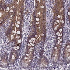 Anti-ACOT11 antibody produced in rabbit 