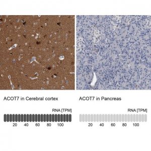 Anti-ACOT7 antibody produced in rabbit HPA025735-100UL