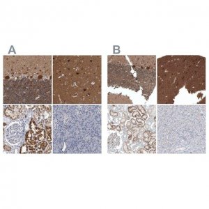 Anti-ACOT7 antibody produced in rabbit HPA025735-100UL