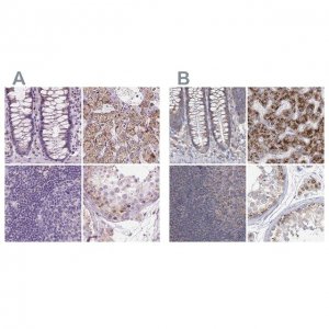 Anti-ACOX2 antibody produced in rabbit 