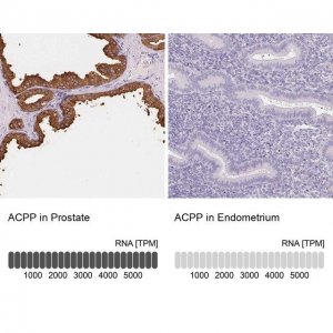 Anti-ACPP antibody produced in rabbit HPA063916-100UL