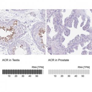 Anti-ACR antibody produced in rabbit 