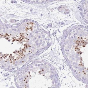 Anti-ACR antibody produced in rabbit 
