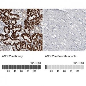 Anti-ACSF2 antibody produced in rabbit 