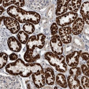 Anti-ACSF2 antibody produced in rabbit 