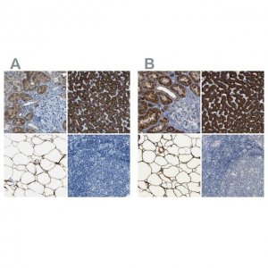 Anti-ACSL1 antibody produced in rabbit 