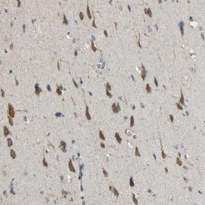 Anti-ACSL4 antibody produced in rabbit 