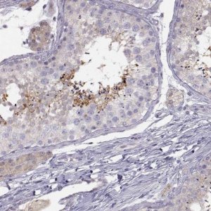 Anti-ACSL6 antibody produced in rabbit 