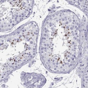 Anti-ACTL7A antibody produced in rabbit 