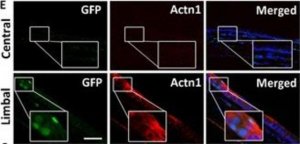 Anti-ACTN1 antibody produced in rabbit HPA006035-100UL
