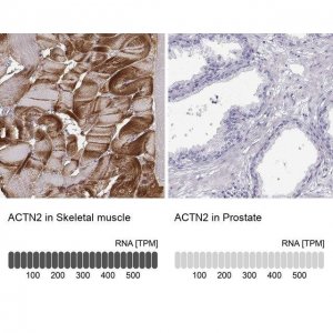 Anti-ACTN2 antibody produced in rabbit 