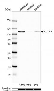 Anti-ACTN4 antibody produced in rabbit 
