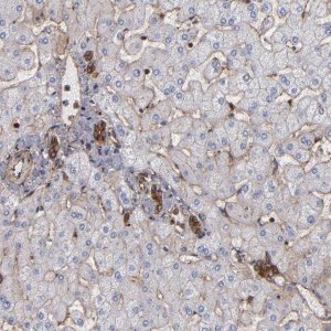 Anti-ACTN4 antibody produced in rabbit 
