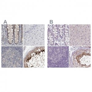 Anti-ACTRT2 antibody produced in rabbit 