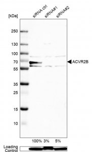 Anti-ACVR2B antibody produced in rabbit 
