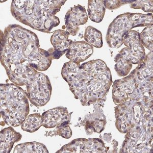 Anti-ACVR2B antibody produced in rabbit 