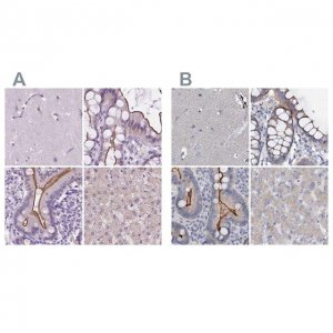 Anti-ACY3 antibody produced in rabbit 