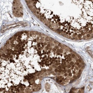 Anti-ACYP1 antibody produced in rabbit 