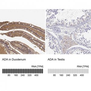 Anti-ADA antibody produced in rabbit 