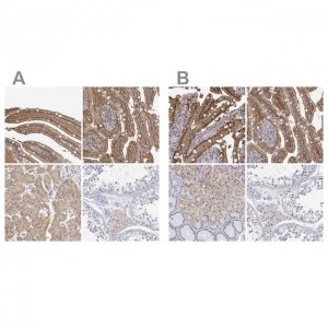 Anti-ADA antibody produced in rabbit 