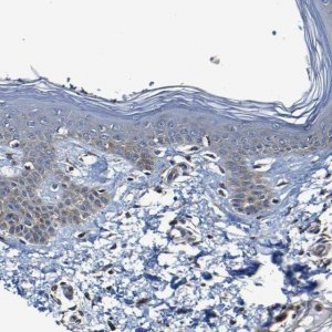 Anti-ADAM15 antibody produced in rabbit 