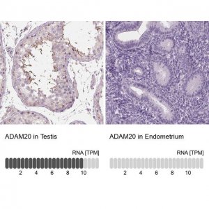 Anti-ADAM20 antibody produced in rabbit 