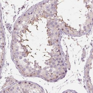 Anti-ADAM20 antibody produced in rabbit 