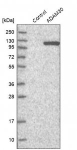 Anti-ADAM30 antibody produced in rabbit HPA026080-100UL