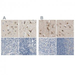 Anti-ADAP1 antibody produced in rabbit 