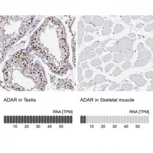 Anti-ADAR antibody produced in rabbit 