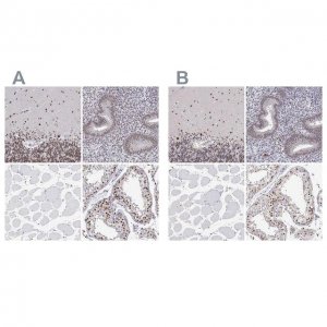 Anti-ADAR antibody produced in rabbit 